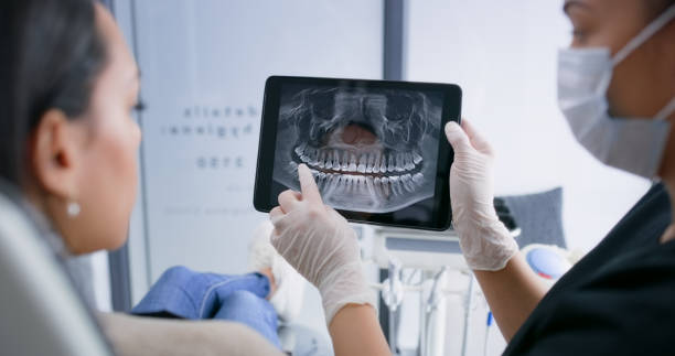 Licensed Dental Implants service in Monterey Park, CA - Smile Center Dentistry